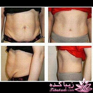 مرکز زیبایی ابریشم نقره ای