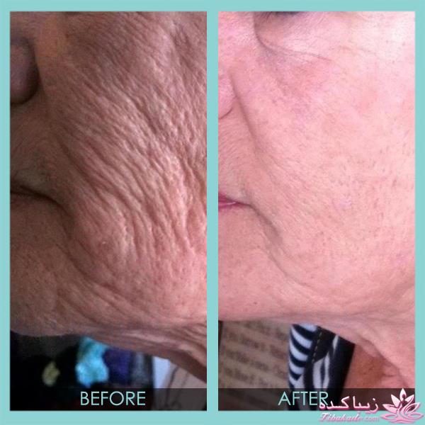 مرکز زیبایی ابریشم نقره ای