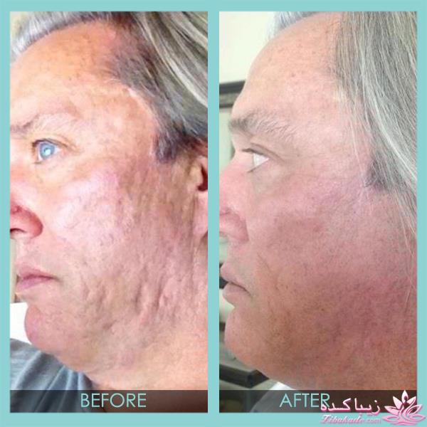 مرکز زیبایی ابریشم نقره ای