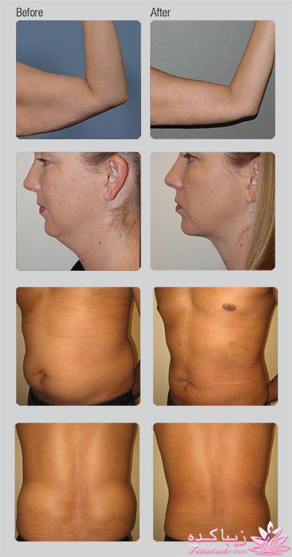 مرکز زیبایی ابریشم نقره ای