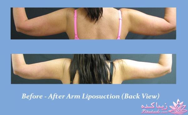 مرکز زیبایی ابریشم نقره ای