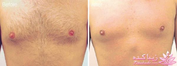 مرکز زیبایی ابریشم نقره ای