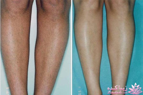 مرکز زیبایی ابریشم نقره ای