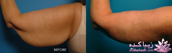 مرکز زیبایی ابریشم نقره ای