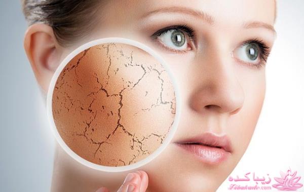 مرکز زیبایی ابریشم نقره ای