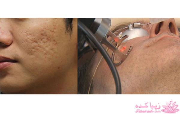 مرکز زیبایی ابریشم نقره ای