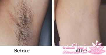 مرکز زیبایی ابریشم نقره ای