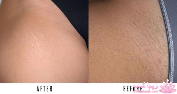 مرکز زیبایی ابریشم نقره ای