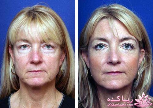 مرکز زیبایی ابریشم نقره ای