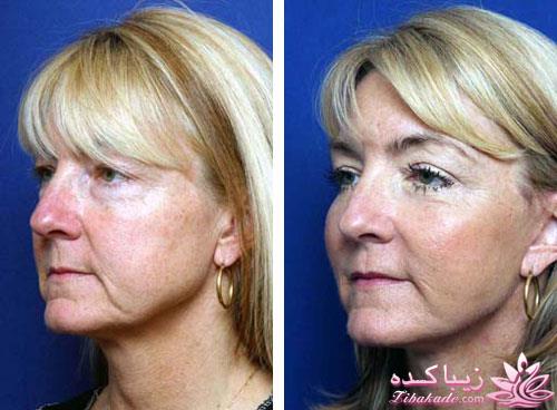 مرکز زیبایی ابریشم نقره ای