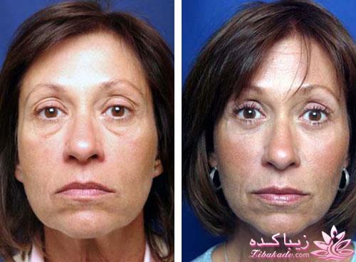 مرکز زیبایی ابریشم نقره ای