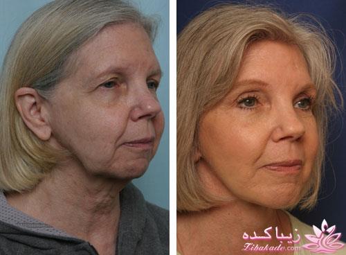 مرکز زیبایی ابریشم نقره ای