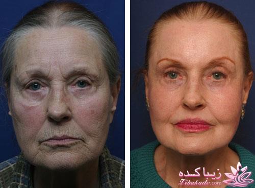 مرکز زیبایی ابریشم نقره ای