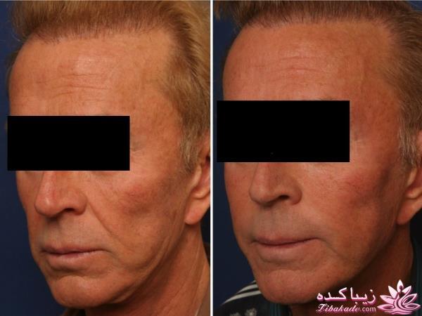 مرکز زیبایی ابریشم نقره ای