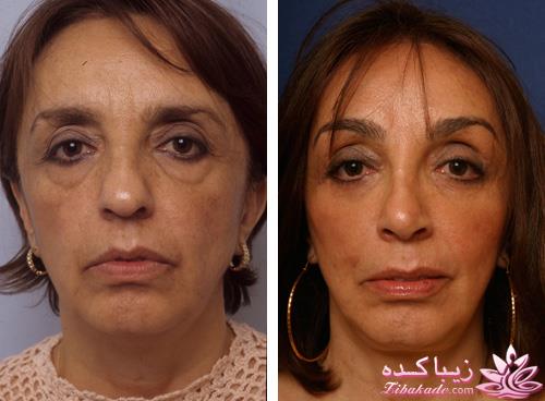 مرکز زیبایی ابریشم نقره ای