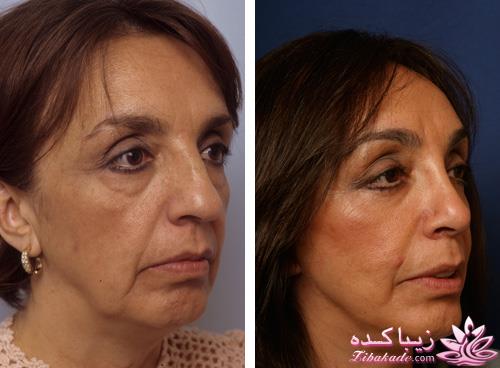 مرکز زیبایی ابریشم نقره ای