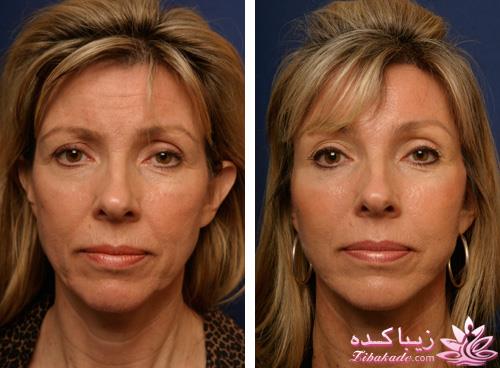 مرکز زیبایی ابریشم نقره ای