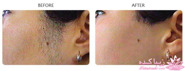 مرکز زیبایی ابریشم نقره ای