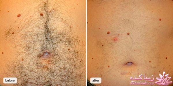 مرکز زیبایی ابریشم نقره ای