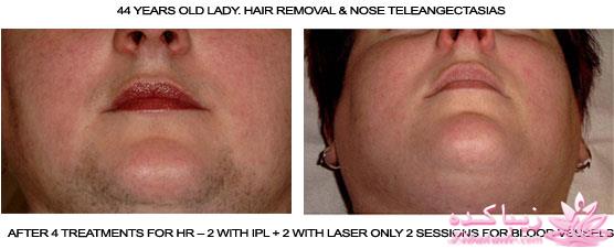 مرکز زیبایی ابریشم نقره ای