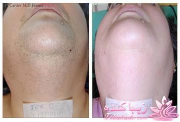 مرکز زیبایی ابریشم نقره ای