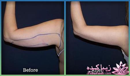 مرکز زیبایی ابریشم نقره ای