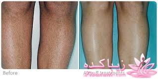 مرکز زیبایی ابریشم نقره ای