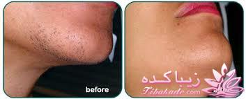 مرکز زیبایی ابریشم نقره ای