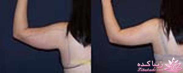 مرکز زیبایی ابریشم نقره ای