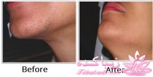 مرکز زیبایی ابریشم نقره ای