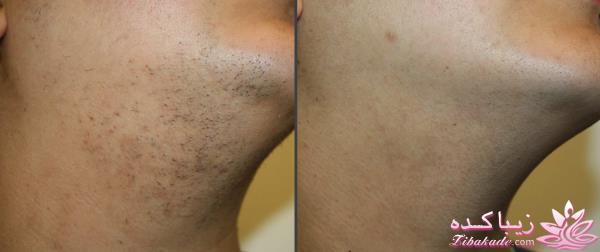 مرکز زیبایی ابریشم نقره ای