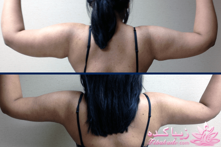 مرکز زیبایی ابریشم نقره ای