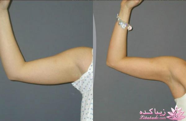 مرکز زیبایی ابریشم نقره ای