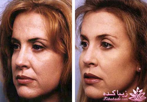 مرکز زیبایی ابریشم نقره ای