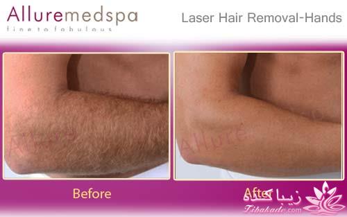 مرکز زیبایی ابریشم نقره ای