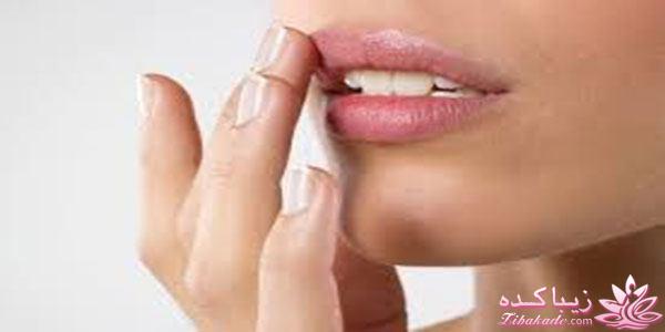 مراقبت از پوست