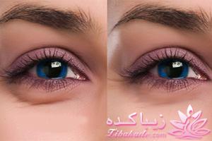 مراقبت از پوست