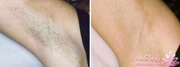 مرکز زیبایی ابریشم نقره ای