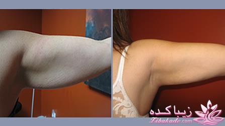 مرکز زیبایی ابریشم نقره ای