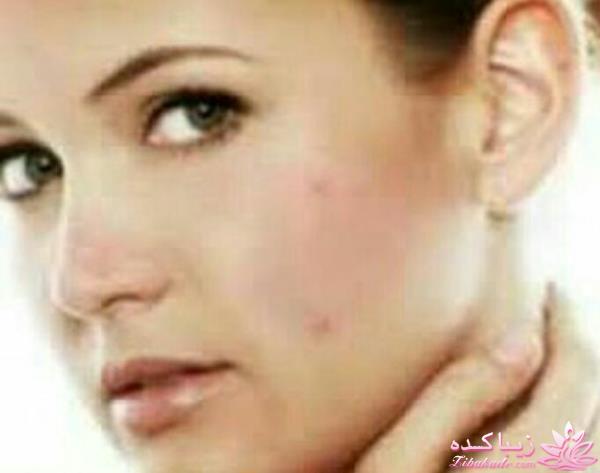 Zibakade Hits / محبوبترینهای زیباکده در تلگرام 