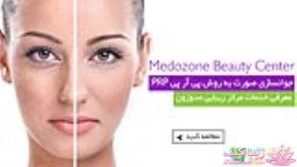 جوانسازی صورت به روش پی آر پی PRP