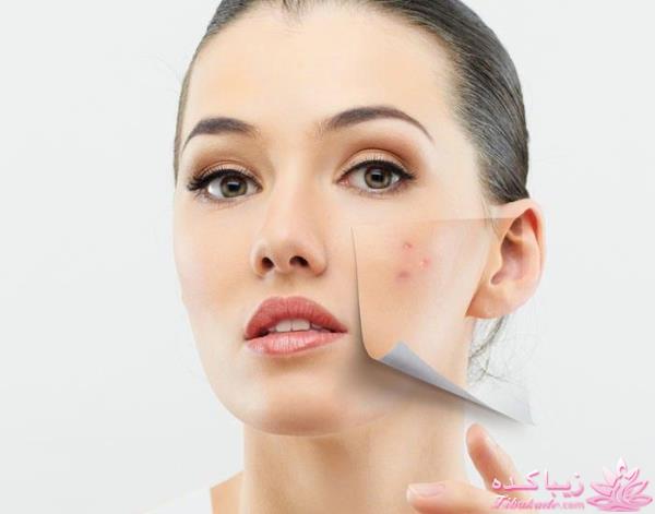 انواع ماسک برای پوست شما