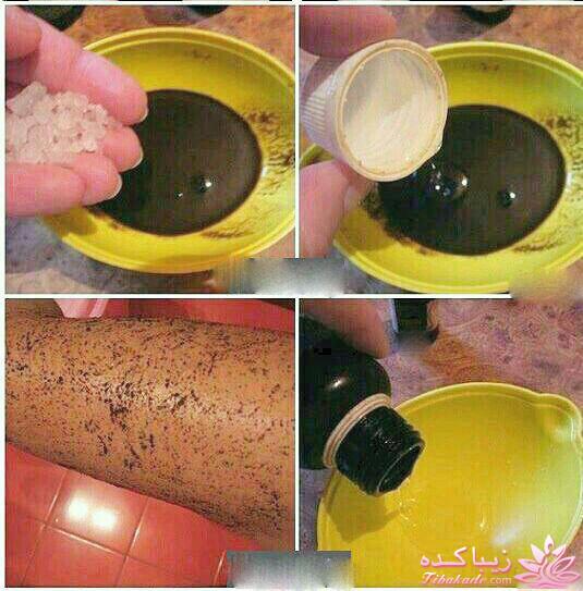 چگونه از شره سلولیت ها راحت شویم؟