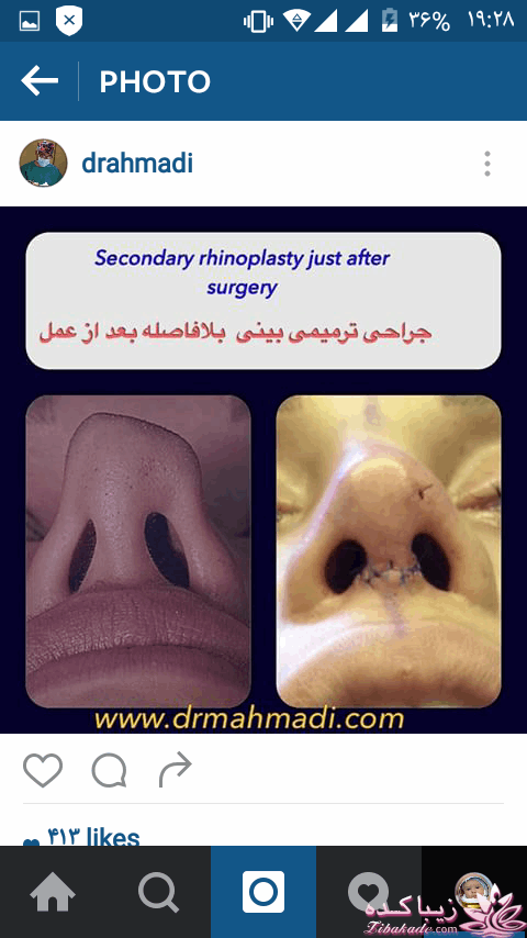 معرفی دکتر برای عمل بینی