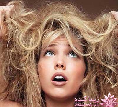 درمان وزی مو