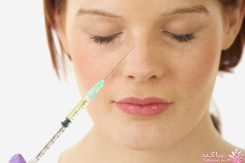 جراحی بینی - دکتر محمد مجلسی