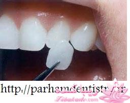 جراحی دندان