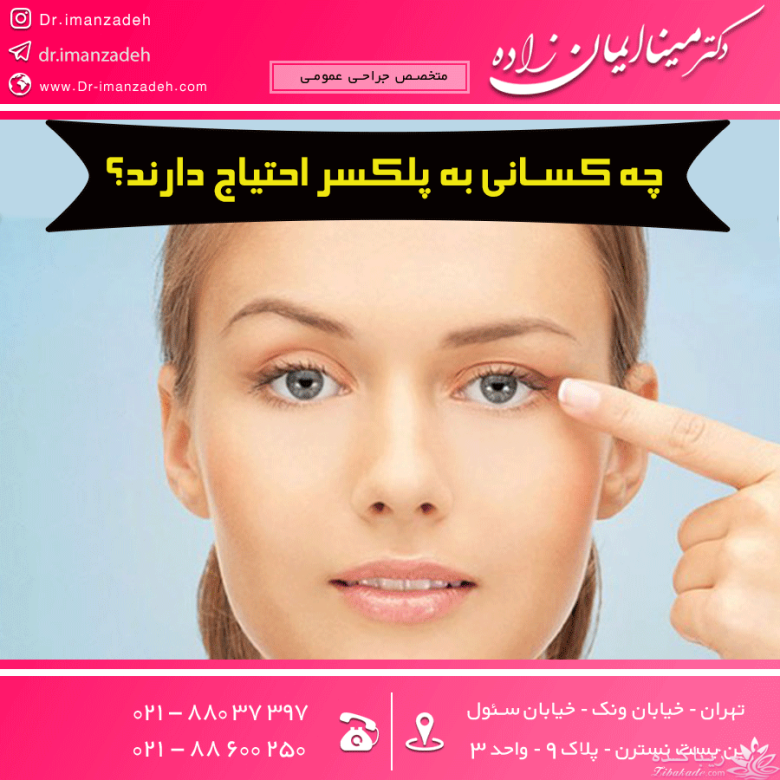 چه کسانی به پلکسر احتیاج دارند؟