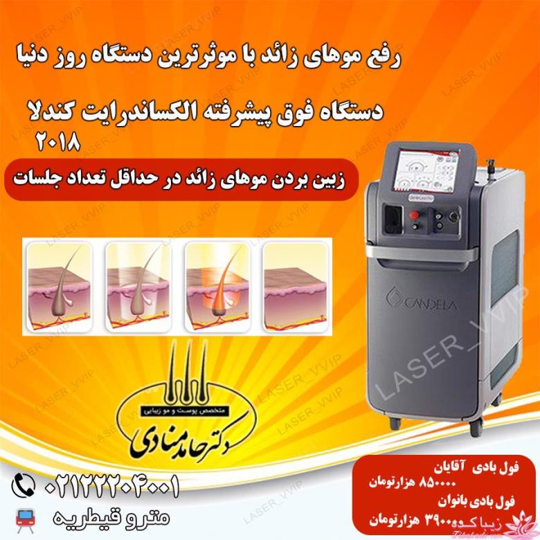 لیزر موهای زائد