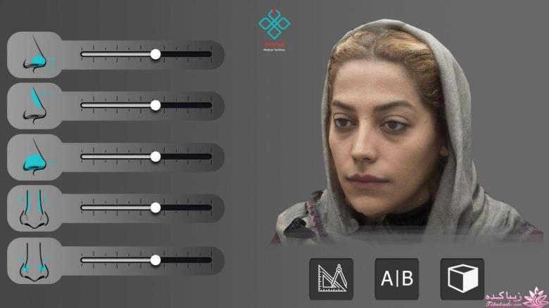 جراحی بینی - جراحی زیبایی